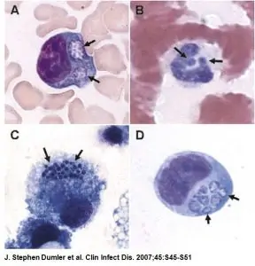 Microscopic Image of Ehrlichia & Anaplasma in Humans