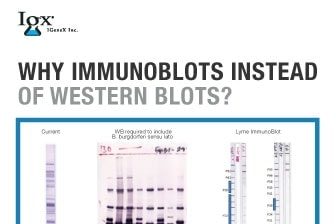 resource-center-why-immunoblots-instead-of-western-blots.jpg