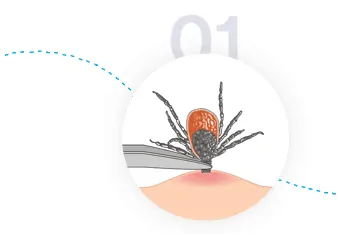 Testing Ticks for Tick-Borne Diseases - Step 1- Remove Tick