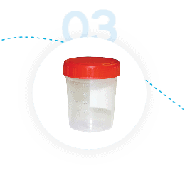 Tick-Borne Disease Urine Testing - Step 3 - Collect Urine Sample at Home